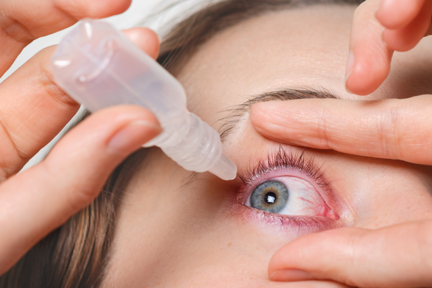 ¿Cuáles son los motivos del síndrome del ojo seco?